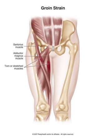 Groin Injuries