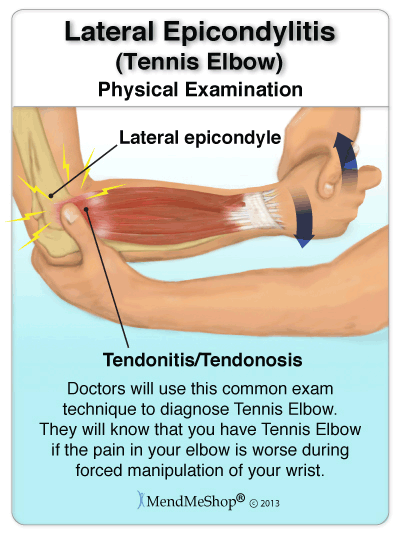 Tennis Elbow Tendonitis Energise Therapy